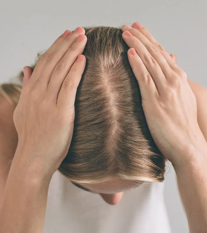 What Are Some Treatment For PCOS Hair Growth? Different Options To Explore