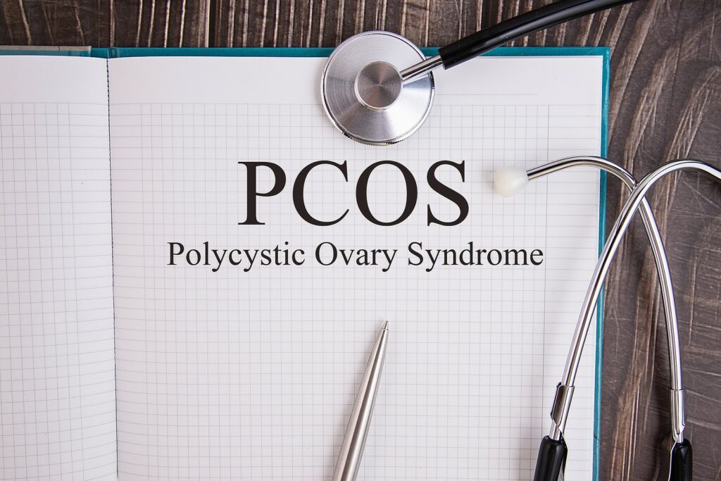 Polycystic Ovary Syndrome Diagnosis : Explore Criteria and Tests