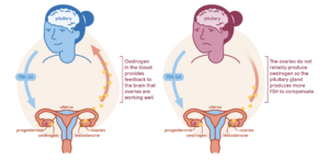 Relationship Between Menopause and Anxiety