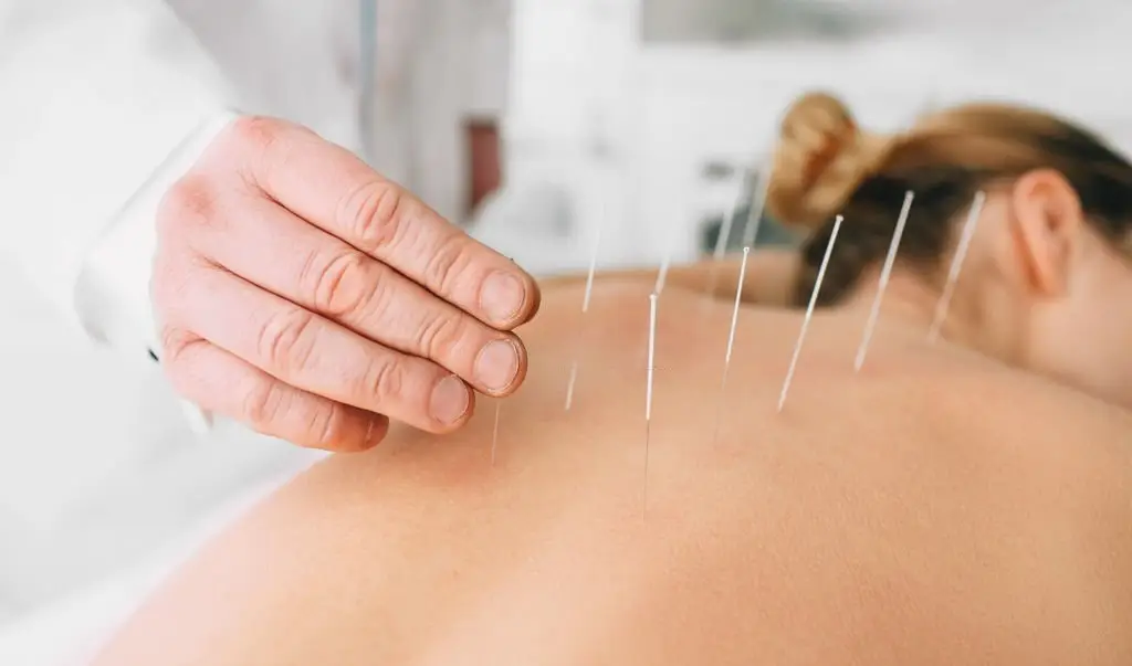 The Role of Acupuncture in Perimenopause-Can It Help