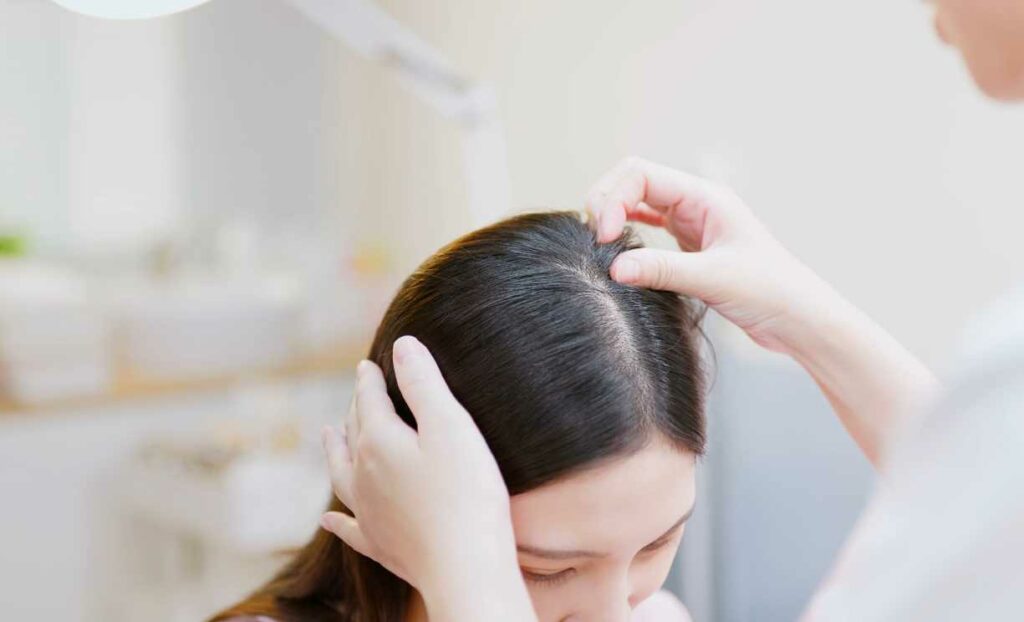 Home Remedies For Thinning Hair Due To Menopause