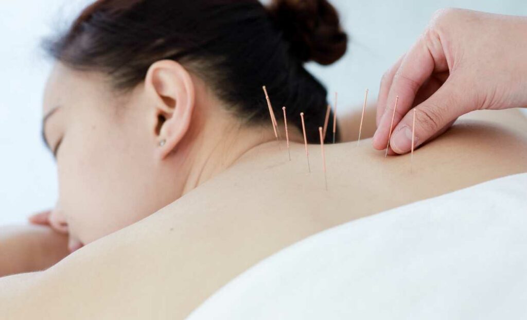 acupuncture for hot flashes menopause
