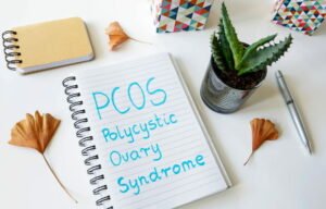 What Are Some Examples Of Drugs For PCOS?