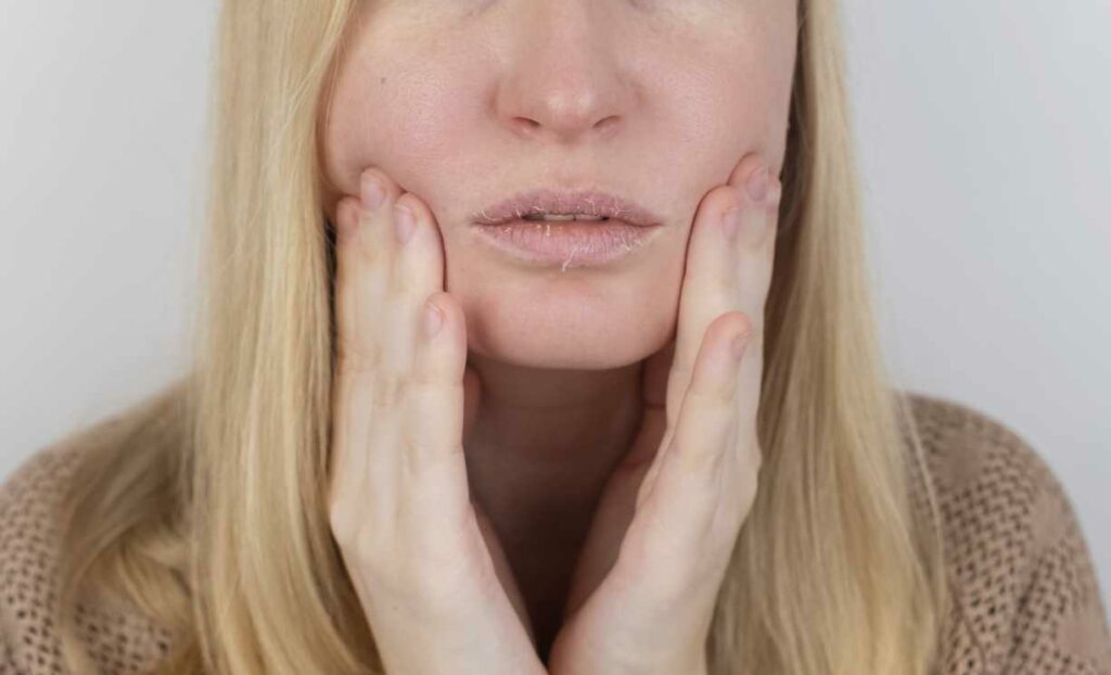 dry lips menopause treatment