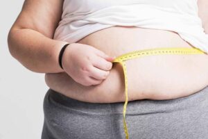 What Are Some Medical PCOS Obesity Treatments?