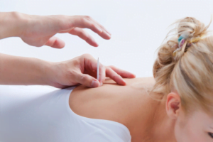 Benefits of Acupuncture for Menopause