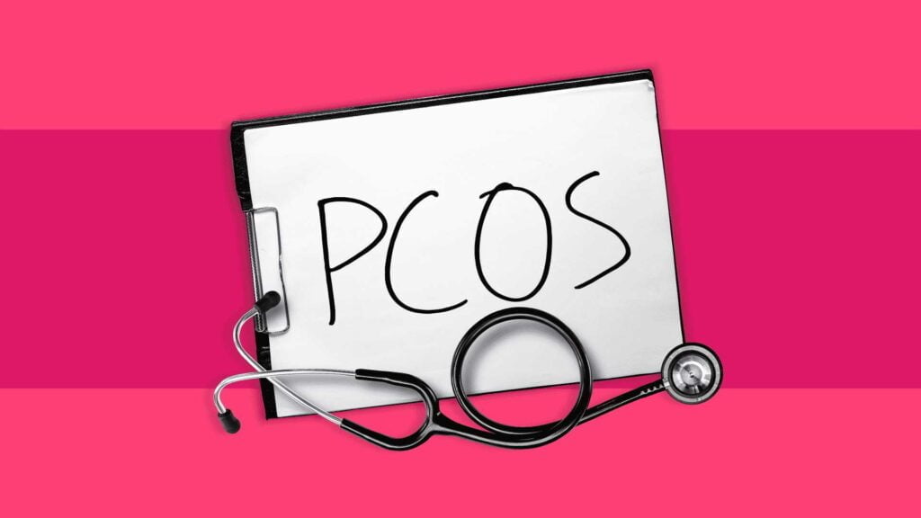 PCOS and Obesity: Your Comprehensive Guide to Effective Treatment Strategies