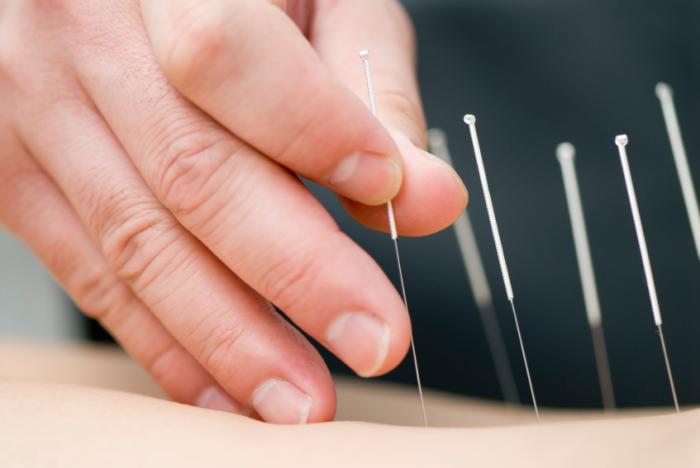 How Acupuncture Works for Menopause?