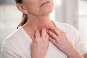 Is Menopause Related To Itching?