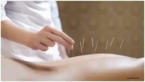 Limitations of Acupuncture for PCOS
