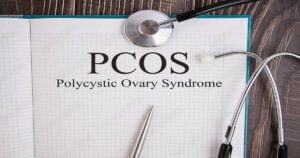 Should I Consider PCOS Medication?