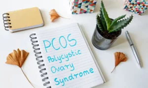 What Is The Relationship Between PCOS And Anovulation?
