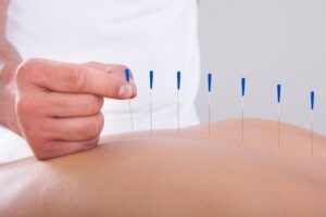 What is “Acupuncture for Hot Flashes”?