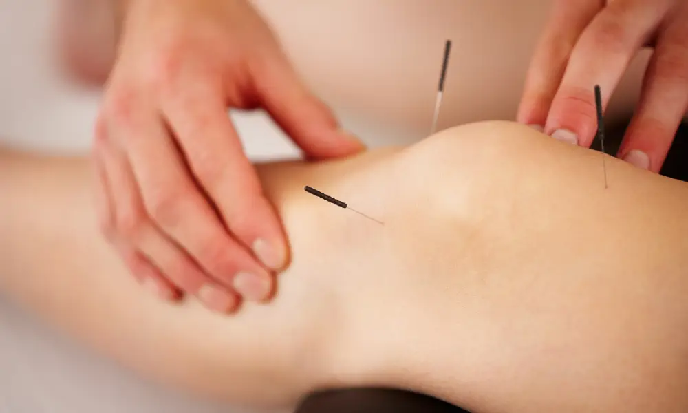 acupuncture for menopausal symptoms