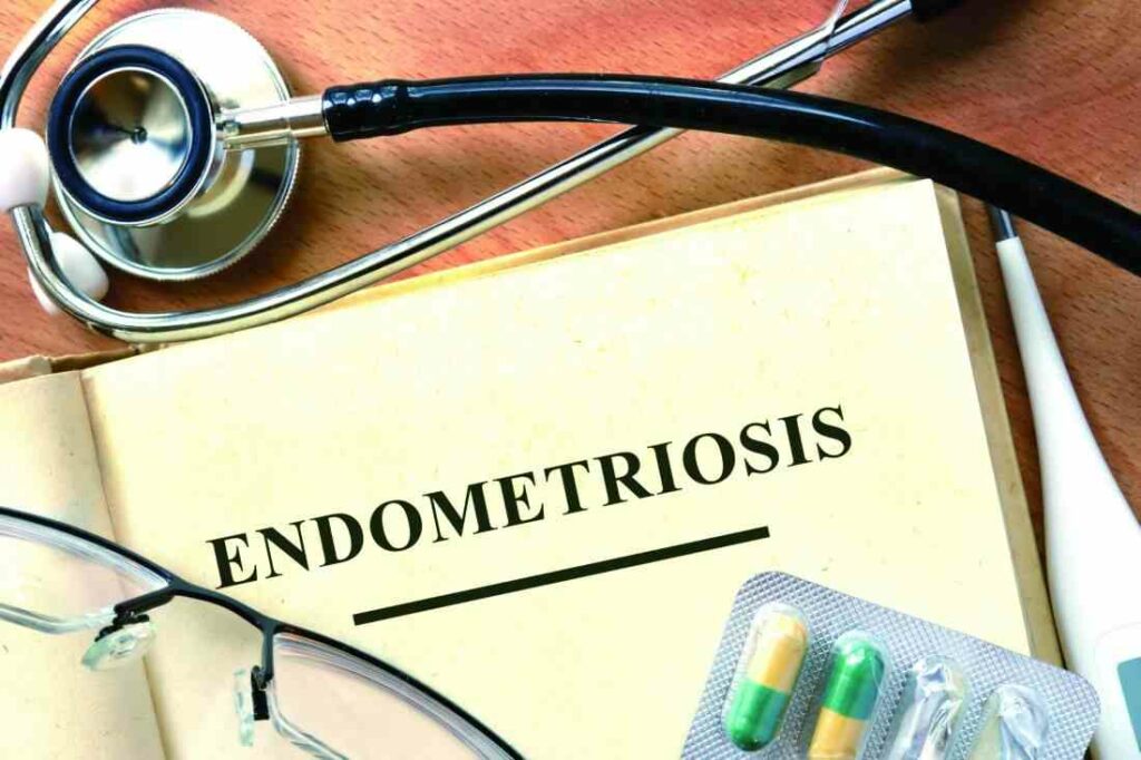 Endometriosis in Menopause: A Comprehensive Guide to Treatment and Support