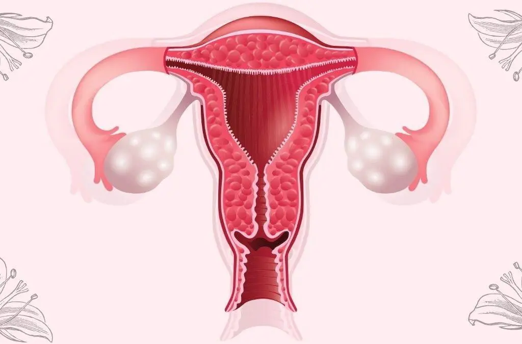 Understanding the Role of Progestin Therapy in PCOS Hormonal Harmony