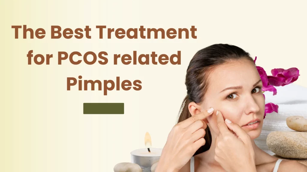 pcos pimples treatment
