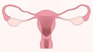 How Can I Ovulate Faster With PCOS?